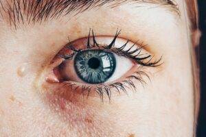 What If I Blink During LASIK? featured image